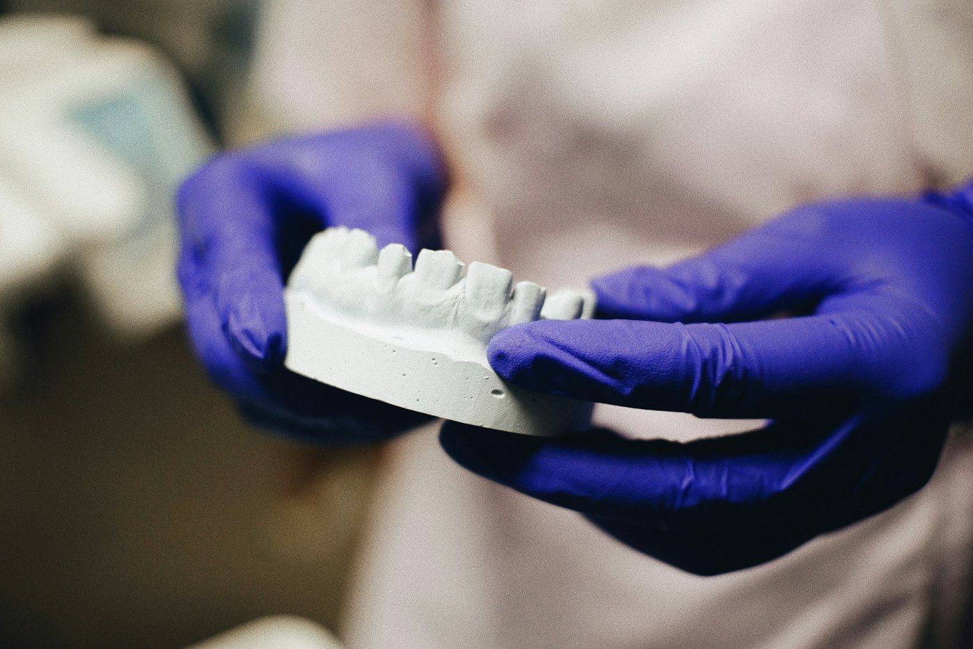 Manos con guantes sosteniendo un modelo de yeso de una dentadura